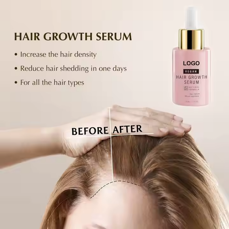 Hair Growth Serum Manufacturer - Pure Natural Rosemary Scalp Nourishing Loss Resistant & OEM