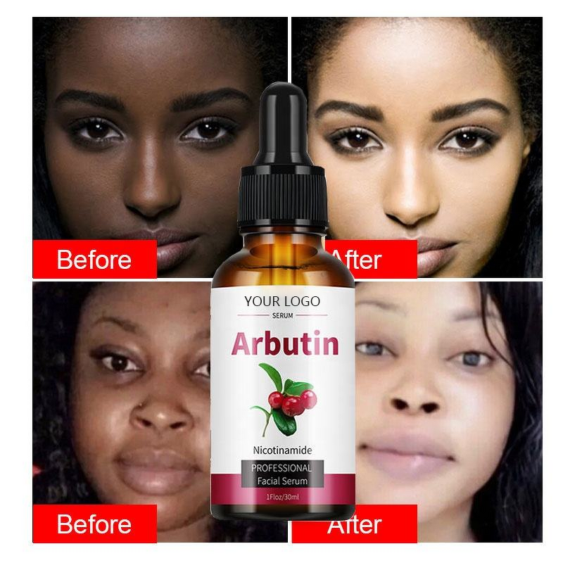 Face Serum Manufacturer - Nourishing Brightening Anti-Dark Spots Whitening with Arbutin Liquid