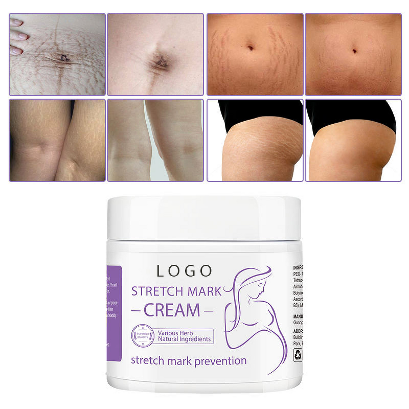 Scar Removal Cream Manufacturer - Organic Vegan for Stretch Mark with Shea Butter & Private Label