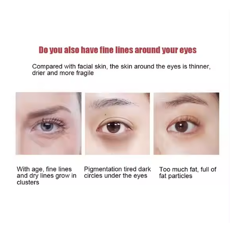 Eye Cream Manufacturer - Retinol Elastic Hydrating with Vitamin C Anti-Wrinkle Firming & OEM J1