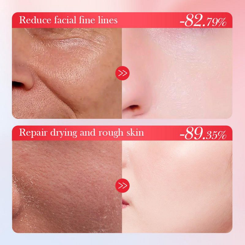 Face Body Serum Manufacturer - Organic Hyaluronic Acid Niacinamide Glycerin for Hydrating Pore Shrinking Anti-Wrinkle