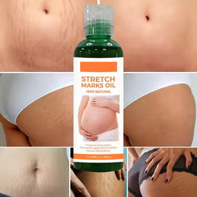 Scar Removal Cream Manufacturer - Organic Skin Revitalizer Stretch Mark Firming Postpartum Oil & Own Brand