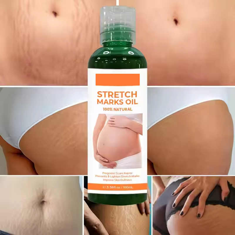 Scar Removal Cream Manufacturer - Organic Skin Revitalizer Stretch Mark Firming Postpartum Oil & Own Brand