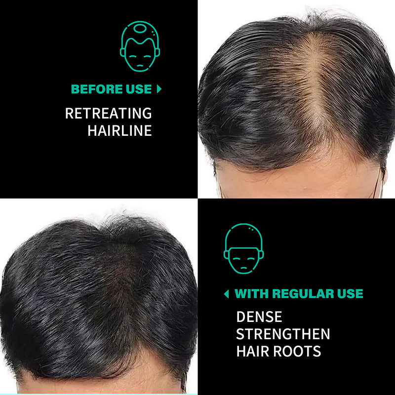 Hair Treatment Oil Manufacturer - 100% Pure Organic Raw Batan for Damaged Hair Growth & Private Label