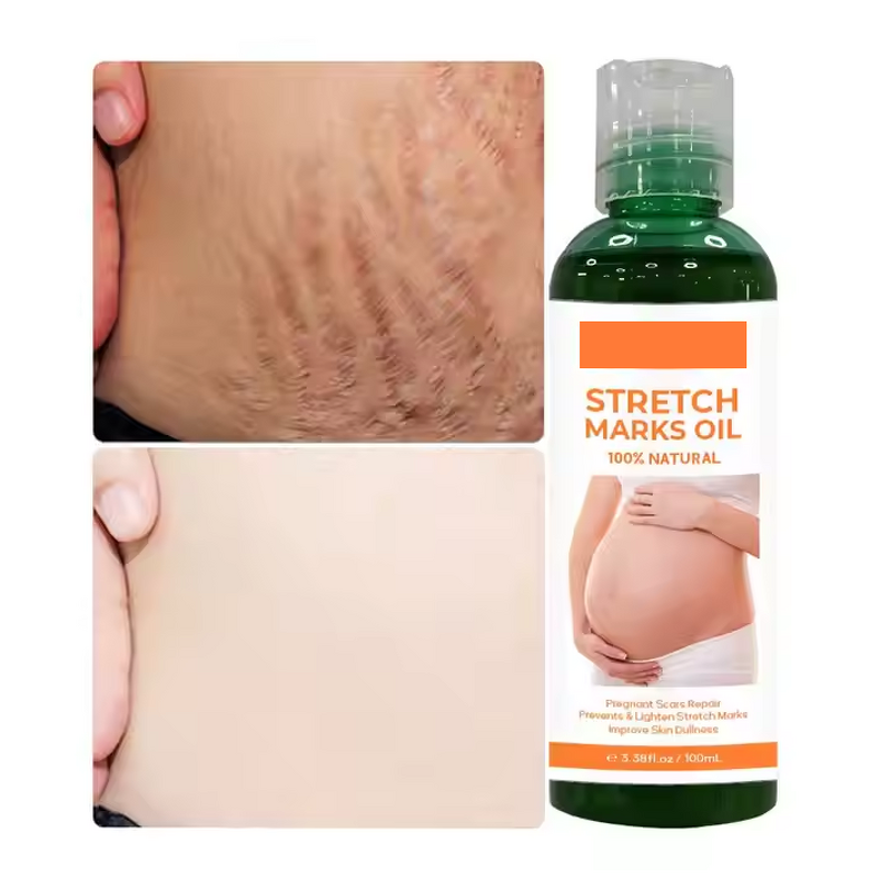 Scar Removal Cream Manufacturer - Organic Skin Revitalizer Stretch Mark Firming Postpartum Oil & Own Brand