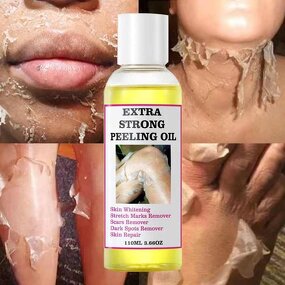 Skin Care Serum Manufacturer - Vitamin C Infused Strong Yellow Peeling Oil for Brightening Scar Removing & Own Brand