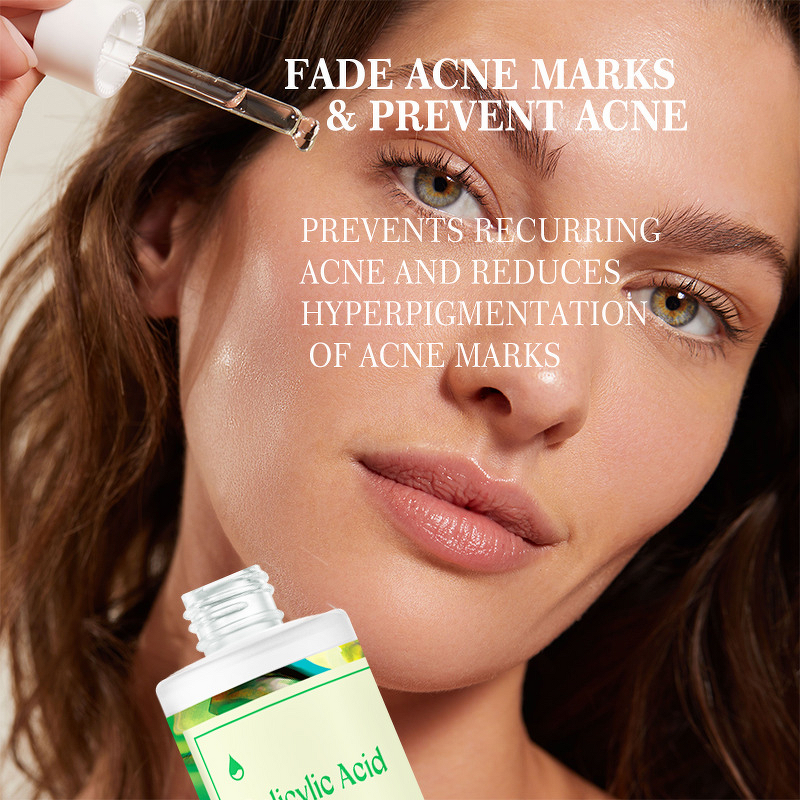 Face Lotion Manufacturer - with Salicylic Acid for Oil Control Acne Removal Desalination Moisturizing
