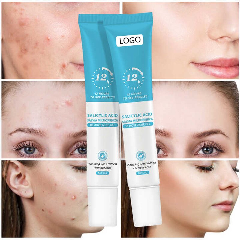 Treatment Cream Manufacturer - Fast Effective Repair Pimple Scar Anti Spots Gel Shrink Pores