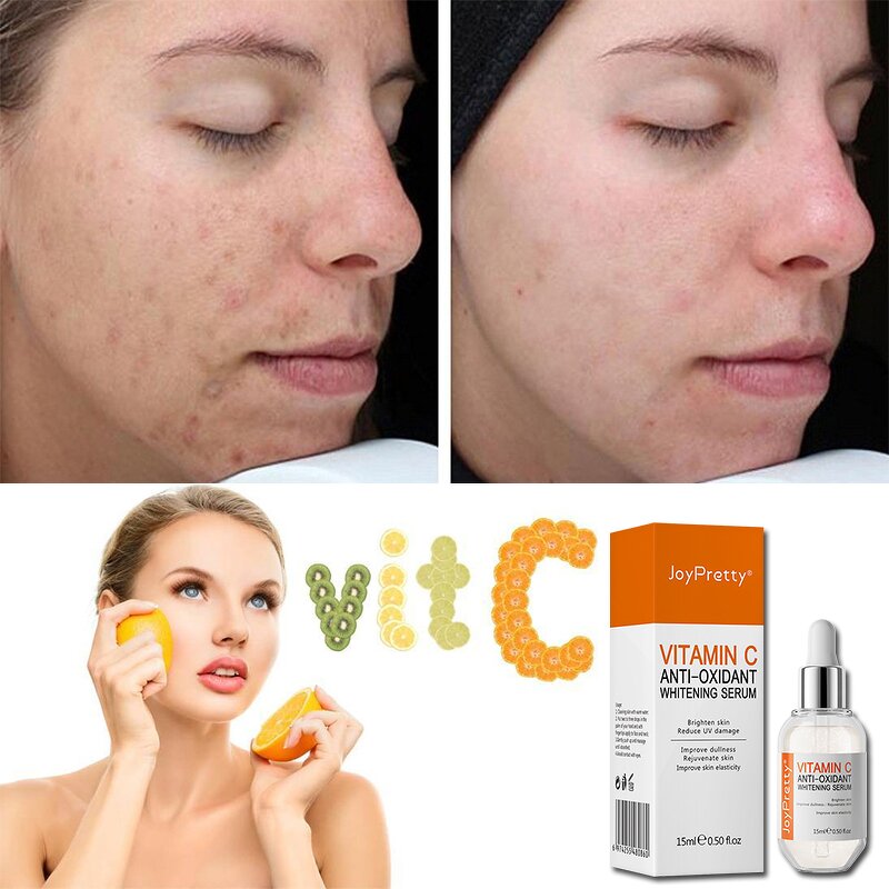 Vitamin C Serum - JoyPretty Private Label Organic Soothing Anti Aging Wrinkles Whitening Custom logo