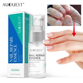 Nail Fungus Treatment - Manufacturer Private Label Anti Fungal Cracked Rough Nail Repair