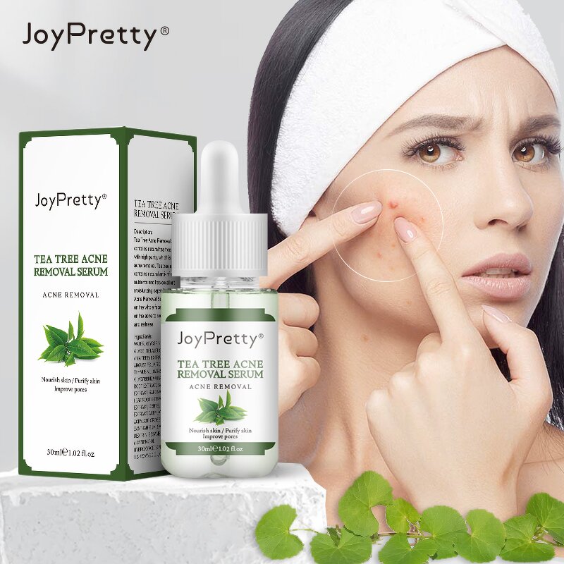 Tea Tree Acne Serum - JoyPretty Natural Organic Moisturizing Whitening Dark Spot Remover