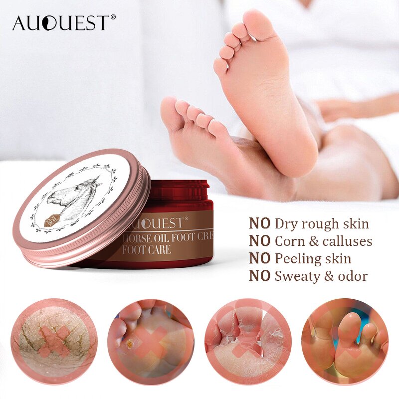 Foot Cream - Private Label Organic Herbal Exfoliating Repair Peeling Whitening Cracked Heels
