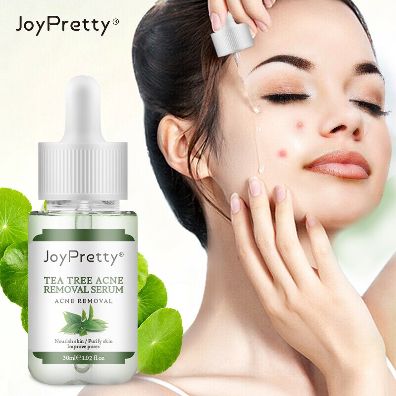 Tea Tree Acne Serum - JoyPretty Natural Organic Moisturizing Whitening Dark Spot Remover