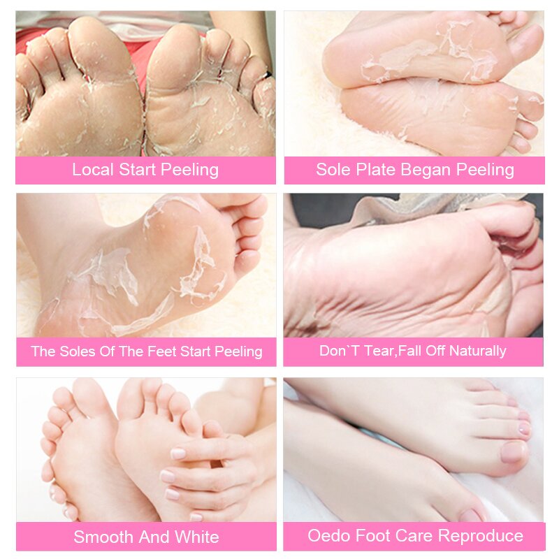 Foot Peel Mask - Wholesale Private Label Organic Moisturizing SPA Exfoliating Hydrating