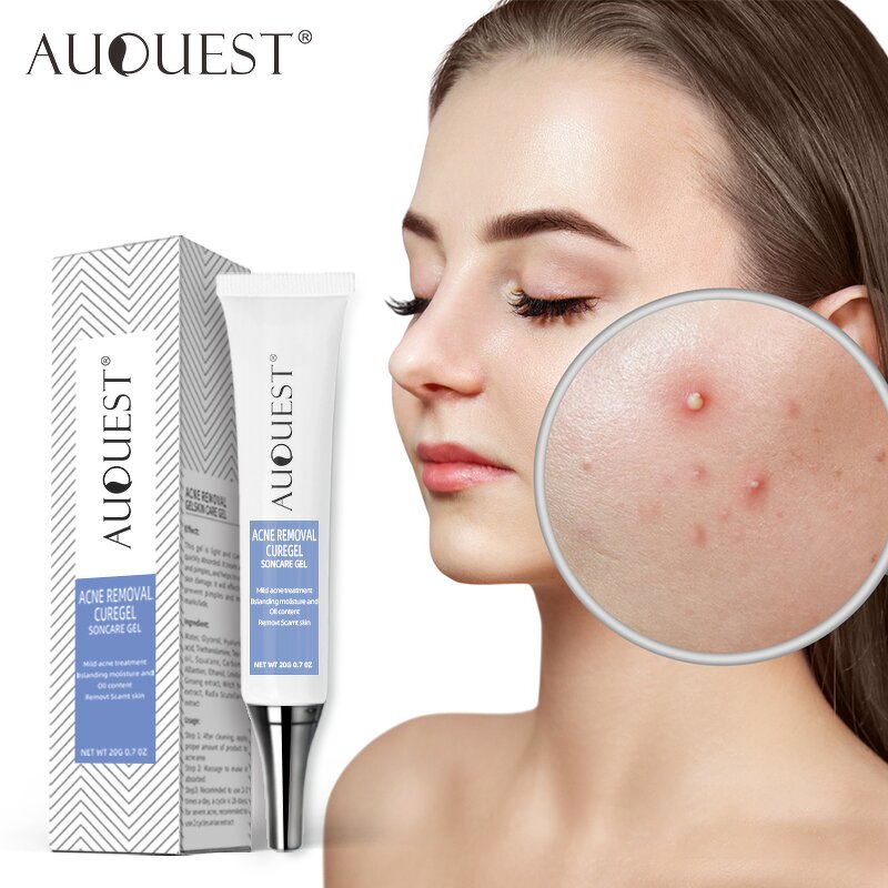 Acne Removal Cream Gel - Stretch Marks Desalt Quick Effective No Side Effects