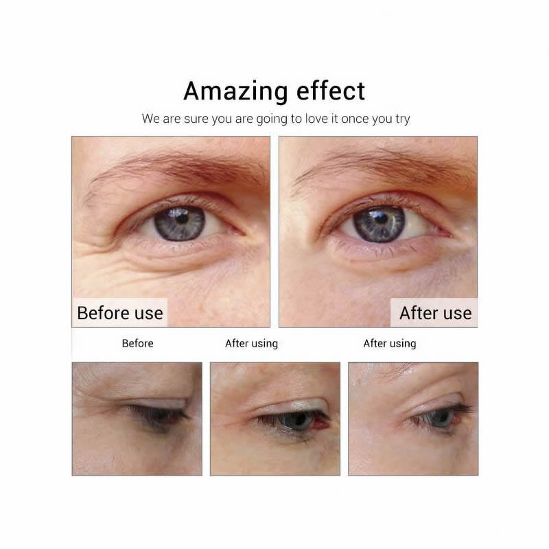 Hyaluronic Acid Serum - Private Label Anti Aging Moisturizing Nourishing Anti Wrinkle