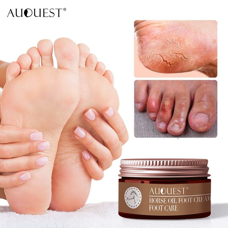 Hand Foot Cream - Chinese Herb Anti-Drying Heel Cracked Repair Dead Skin Removal 4 SIZE