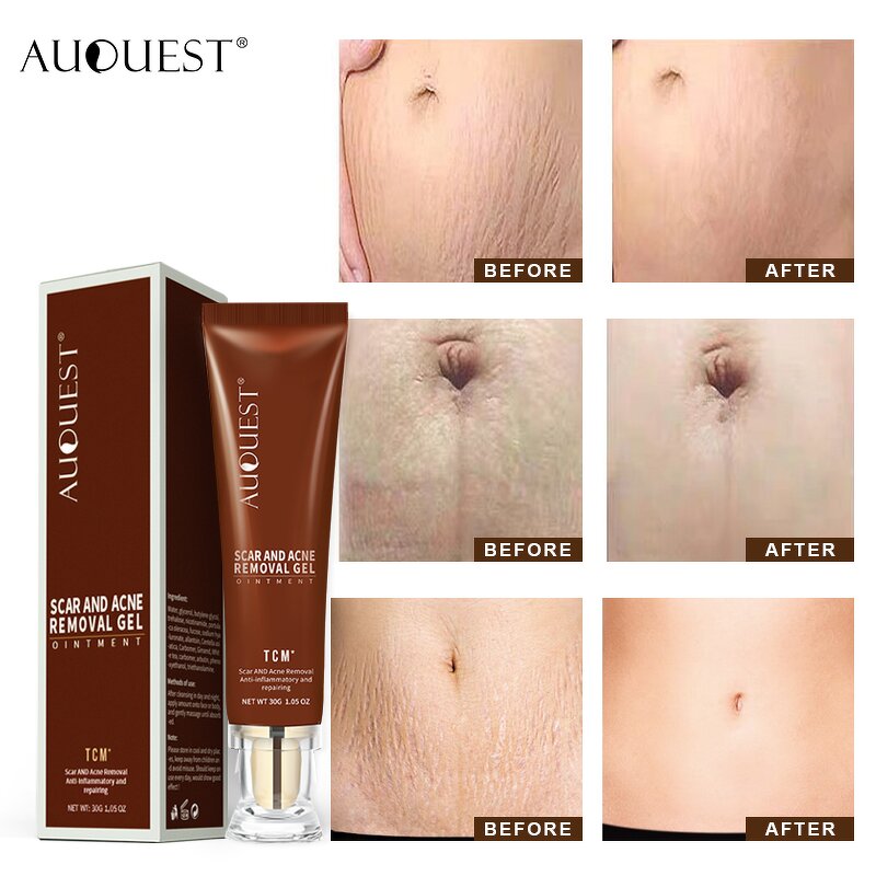 Scar Removal Gel Cream - OEM Dark Spot Repairing Acne Burn Scar Skin Care