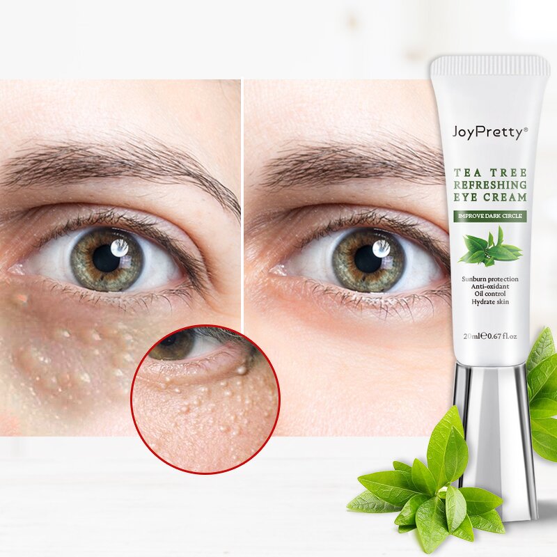 Tea Tree Eye Cream - JoyPretty Organic Dark Eye Bag Remove Brightening Repair OEM/ODM