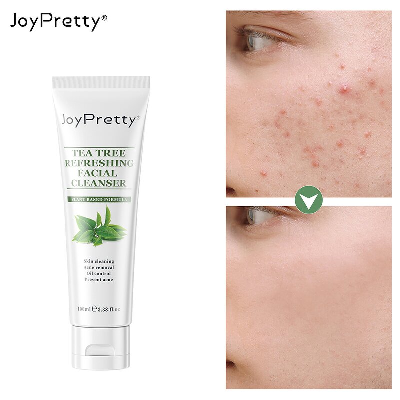 Tea Tree Face Wash - JoyPretty Private Label Deep Cleansning Pore Moisturizing Oil Control