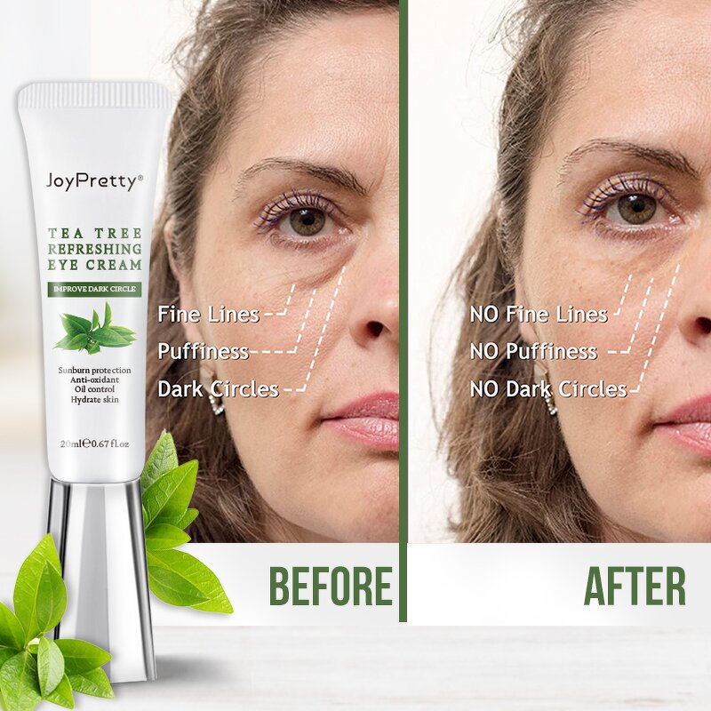 Tea Tree Eye Cream - Organic Anti Wrinkle Eye bag Dark Circle Anti Aging Skin Care Wholesale