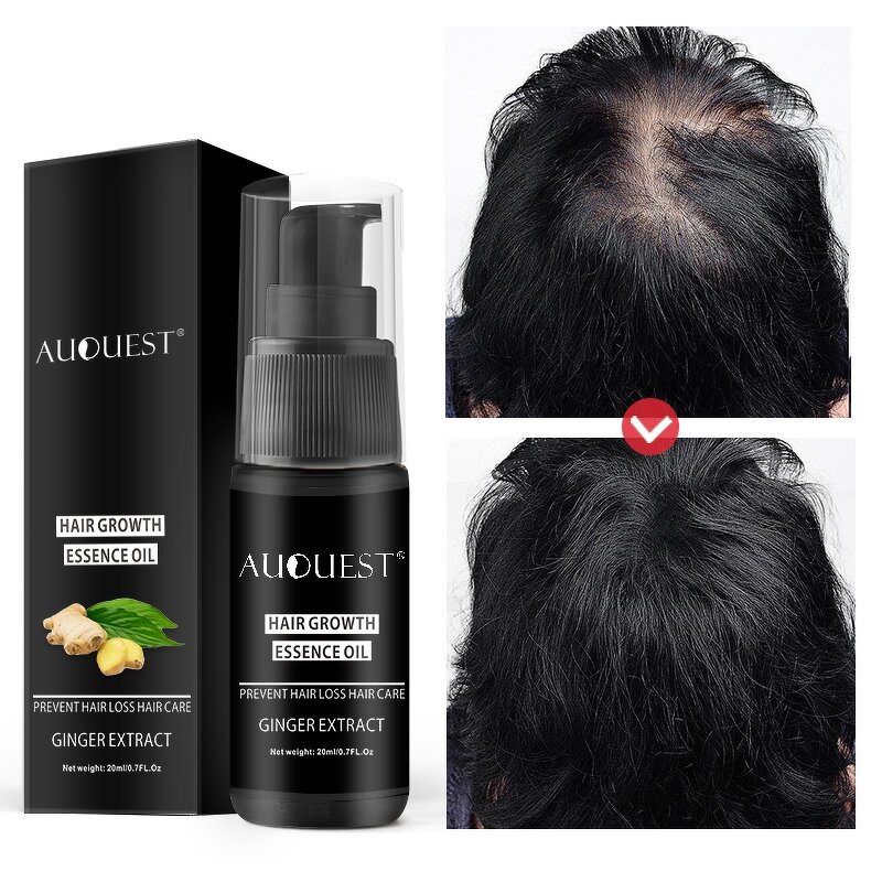 Hair Growth Serum - Private Label Herbal Argan Oil Hair Loss Treatment All Hair Types