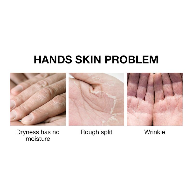 Urea Foot Cream - Private Label 40% Whitening Repair Moisturizing Peel Crack Heel Care