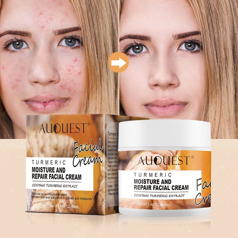 Turmeric Acne Face Cream - Private Label Natural Brightening Dark Spot Removing Pimple
