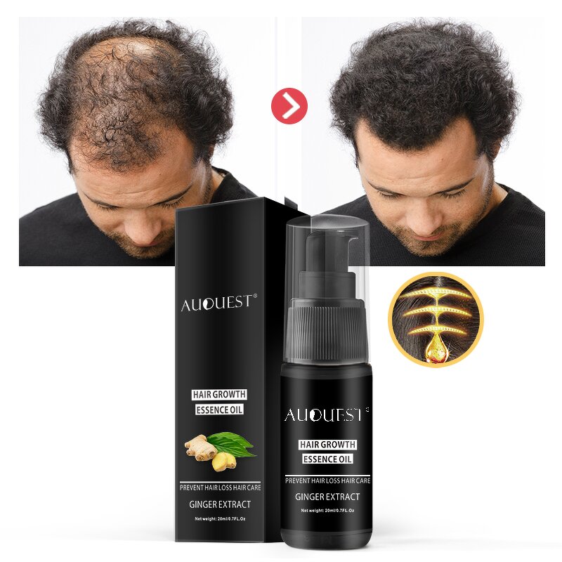 Hair Growth Serum - OEM Magical Instant Repair Hair Loss Treatment Hot Selling