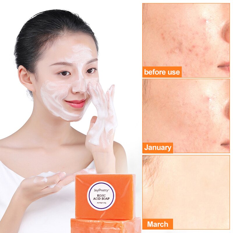 Kojic Acid Soap - Private Label Organic Handmade Oily Skin Whitening Facial Cleanser