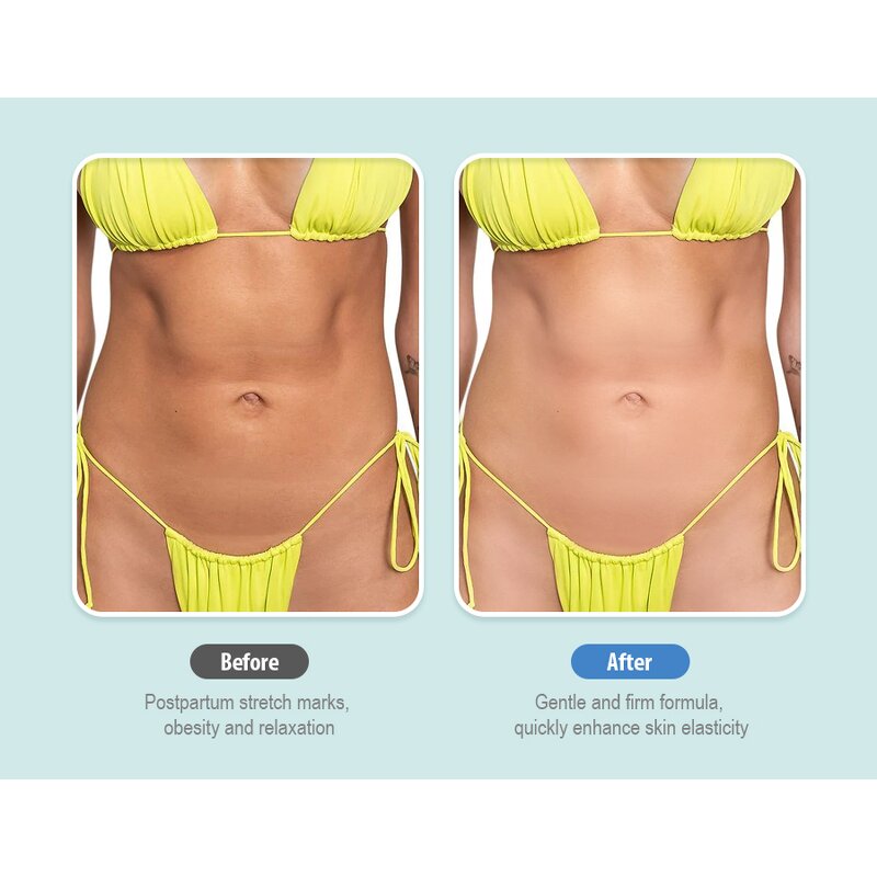 Peach Belly Mask - Private Label Cruelty-free Vegan Firming Moisturizing Smoothing Sheet