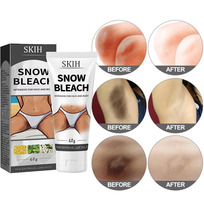 Whitening Cream Manufacturer - New Arrival Repair Armpit Elbow Knee Joints Melanin Whitening Skin Moisturizing & SKIH