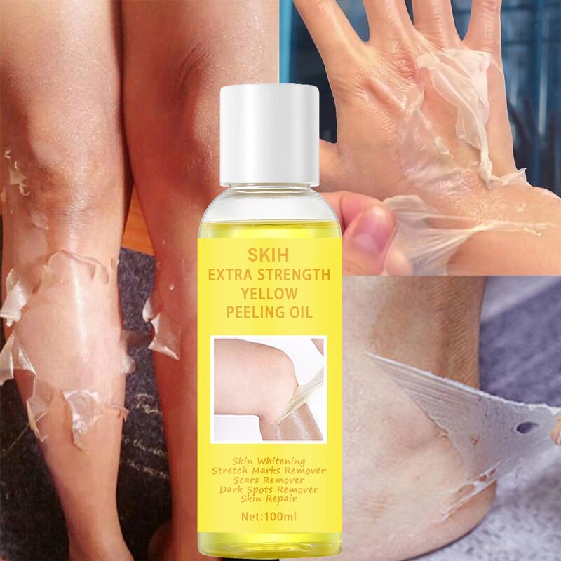 Peeling Oil Manufacturer - Yellow and Green Knuckle Whitening Moisturizing Dark Spot Removal Extra Strength & SKIH OEM