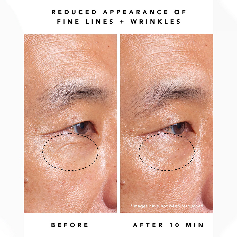 Bakuchiol Eye Cream - Private Label Anti-Wrinkle Retinol Alternative 1% Peptides Dark Circles