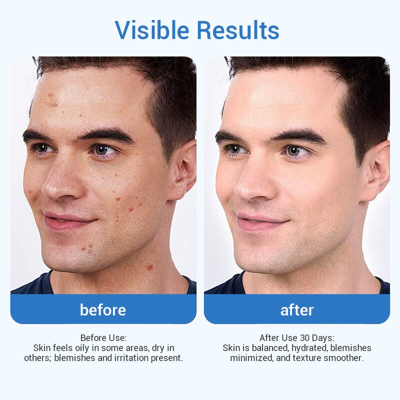 Herbal Repair Cream - Private Label Niacinamide Panthenol Tea Tree 50ml Blemishes Minimized