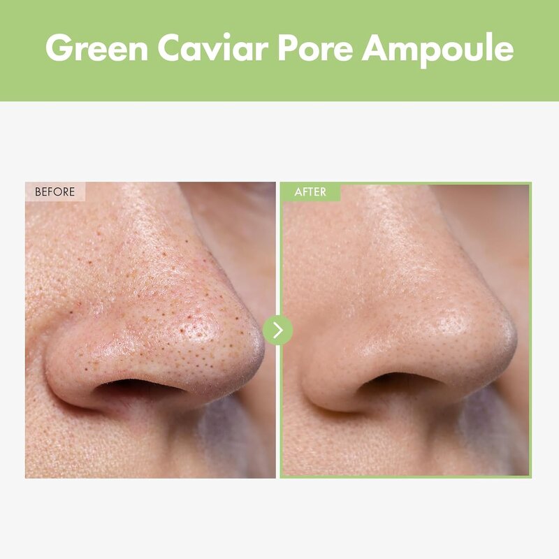 Green Caviar Serum - Private Label Niacinamide Hyaluronic Acid Instant Pore Minimizer Shrink