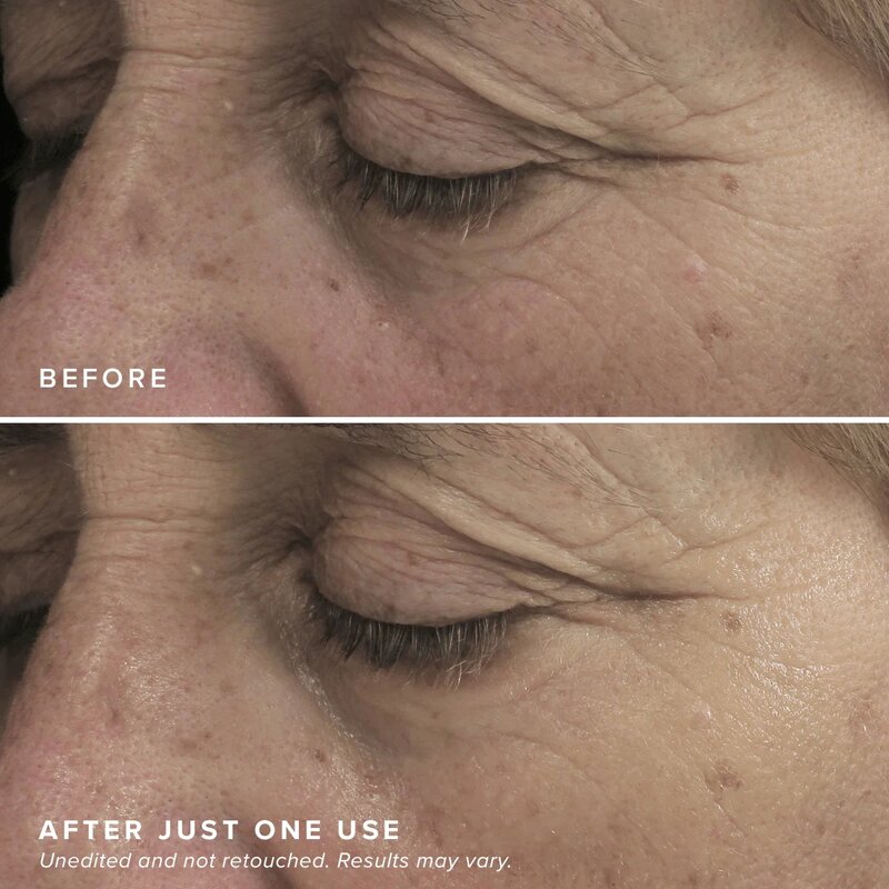 Caffeine Brightening Eye Mask - Private Label Custom Hyaluronic Acid Niacinamide Hydrogel