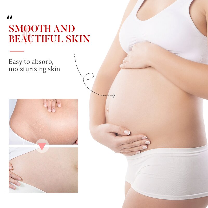 Pregnancy Skin Firming Kit - Private Label Stretch Mark Oil Cream Nipple Cream Breastfeeding