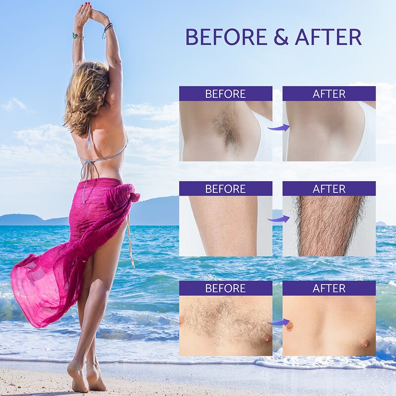 Hair Growth Inhibitor Spray - OEM Painless Permanent Hair Removal Stop Growth Spray