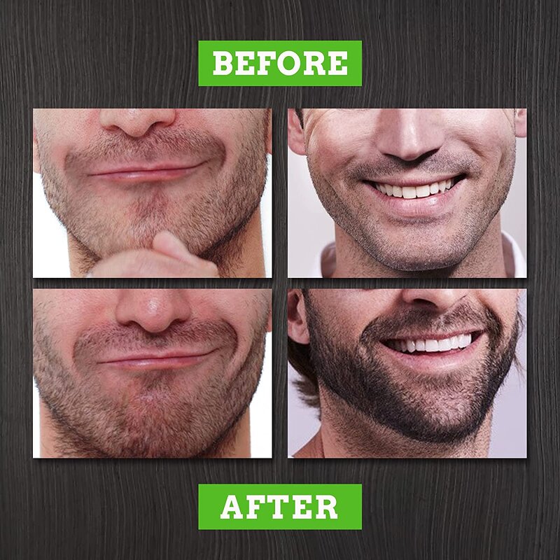 Men's Grooming Kit - Private Label Vegan Herbal Beard Oil Growth Serum Roller Maintenance