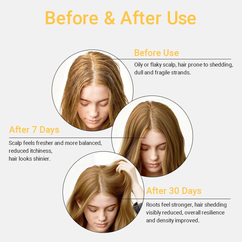 Tea Tree Hair Serum - Private Label Microbiome Balance Caffeine Smooth Hydrate Strengthening