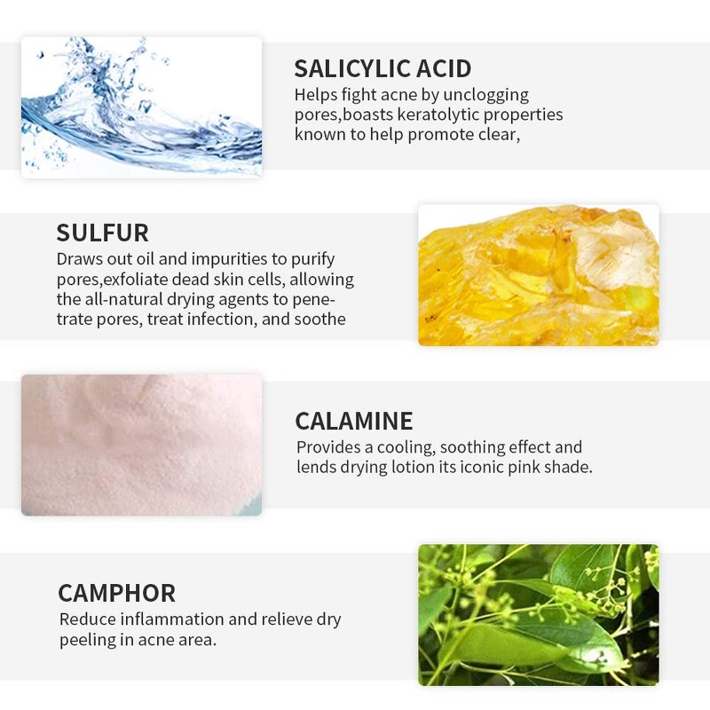 Acne Drying Lotion - OEM Private Label Hot Selling Pimple Scar Removal Calamine Serum