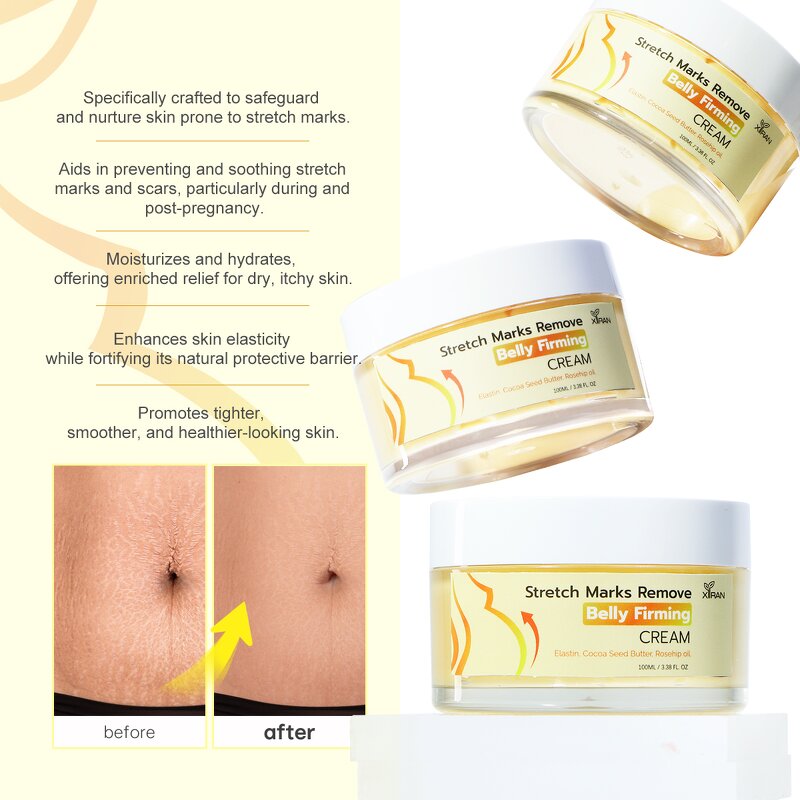 Stretch Mark Removal Cream - 100% Natural Vegan Postpartum Scar Maternity Belly Firming