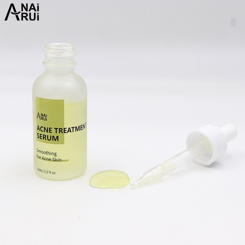 Green Tea Acne Serum - Private Label OEM Blackhead Remover Skin Care Acne Treatment
