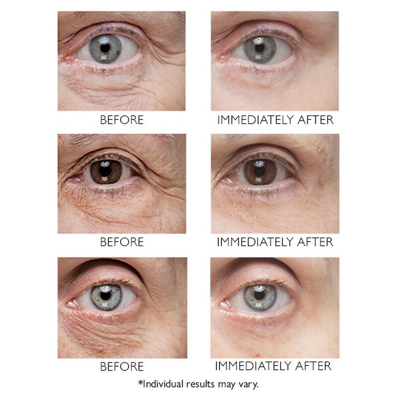 Anti-Aging Eye Lift Cream - Private Label Custom Dark Circles Bags Puffiness Instant Tightening