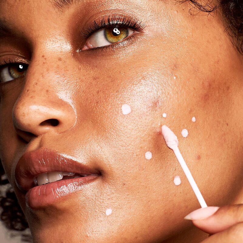 BHA Zinc Oxide Acne Serum - OEM Quickly Clear Pimples Control Oil Reduce Redness