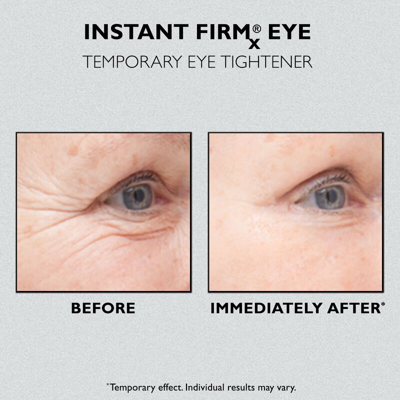 Anti-Aging Eye Lift Cream - Private Label Custom Dark Circles Bags Puffiness Instant Tightening