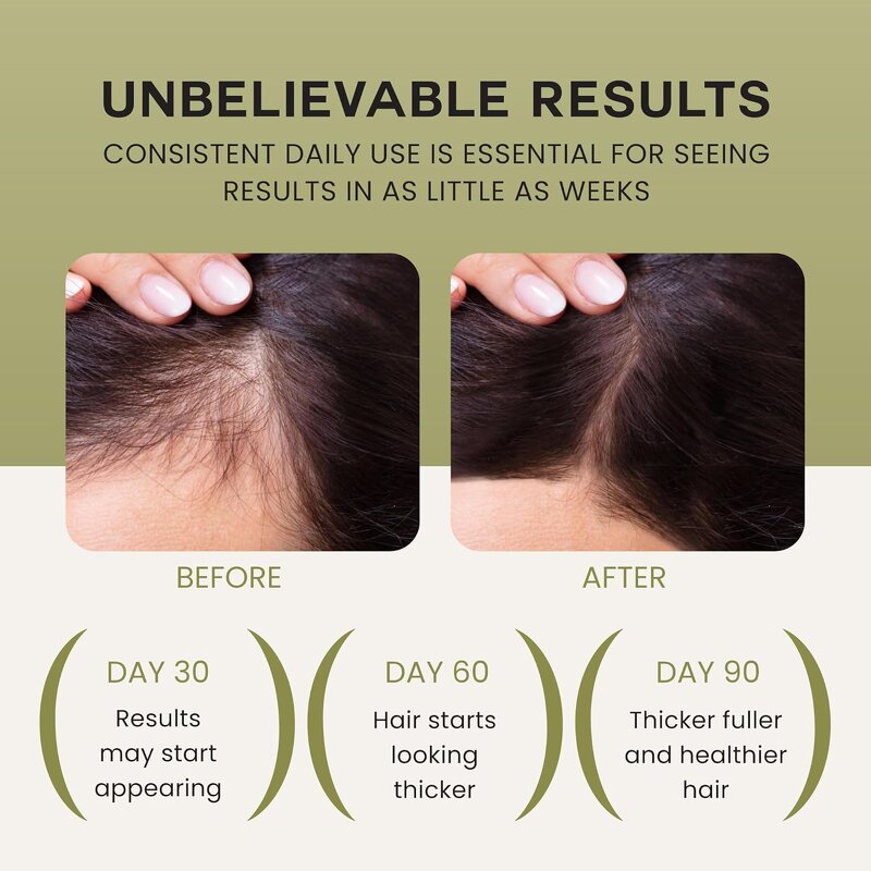 Batana Rosemary Hair Oil - Private Label 5 in 1 Castor Anti Hair Loss Fast Growth Serum