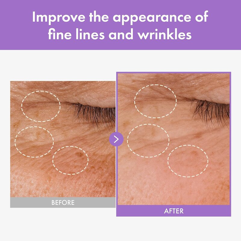 Bakuchiol Capsule Serum - Private Label Retinol Alternative Anti Wrinkle Ceramide Peptide Firming