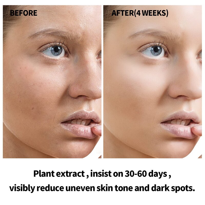 Squalane Vitamin C Oil - Turmeric Moisturizer Facial Oil Natural Skin Brightening